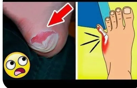En Acı veren şeyler