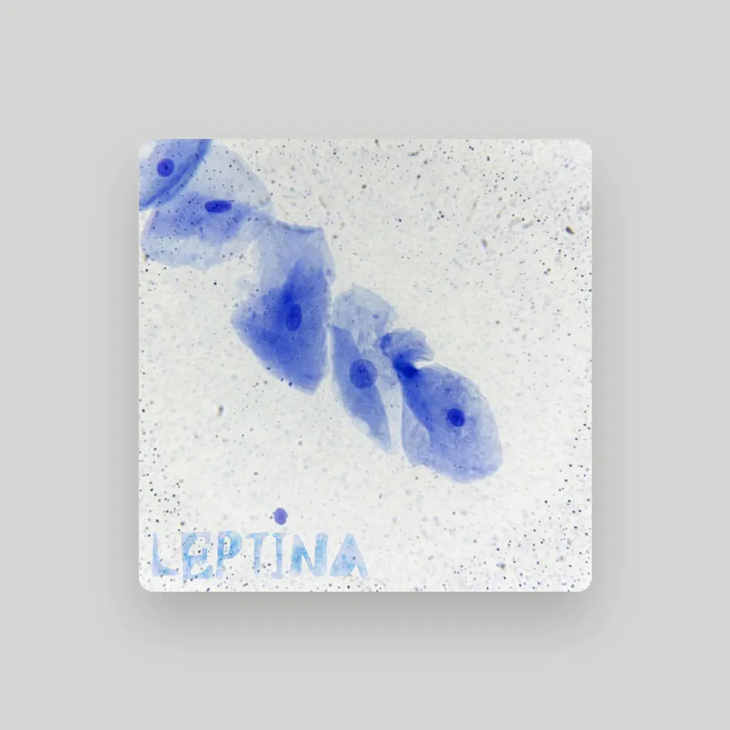 Leptina