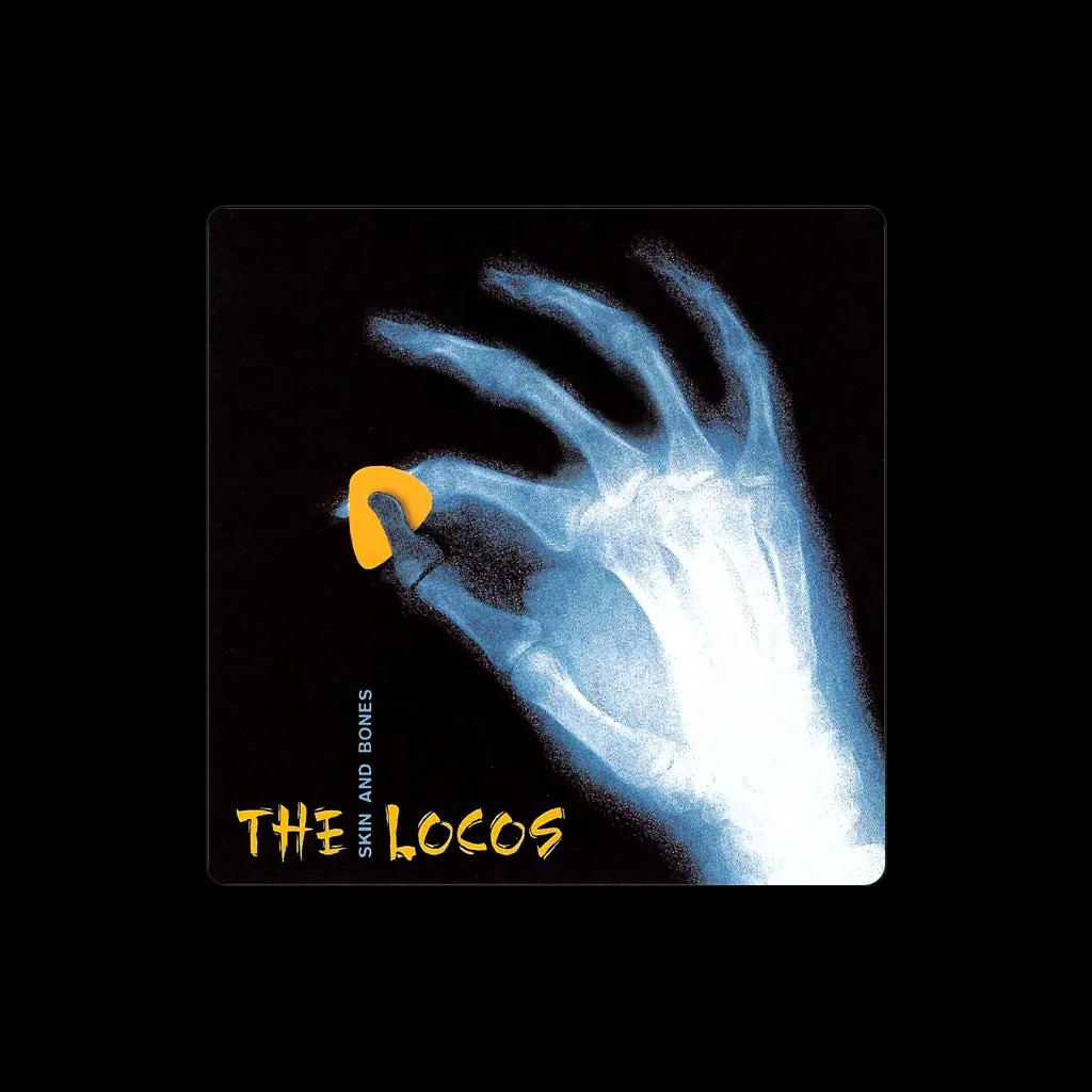 The Locos